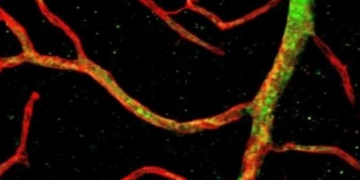 Desarrollan la primera tecnología endovascular que puede explorar capilares