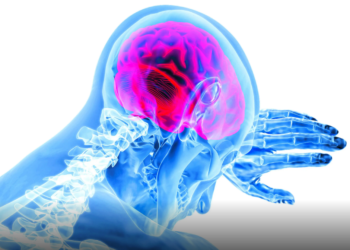 Enfermedad cerebrovascular es segunda causa de muerte en el mundo