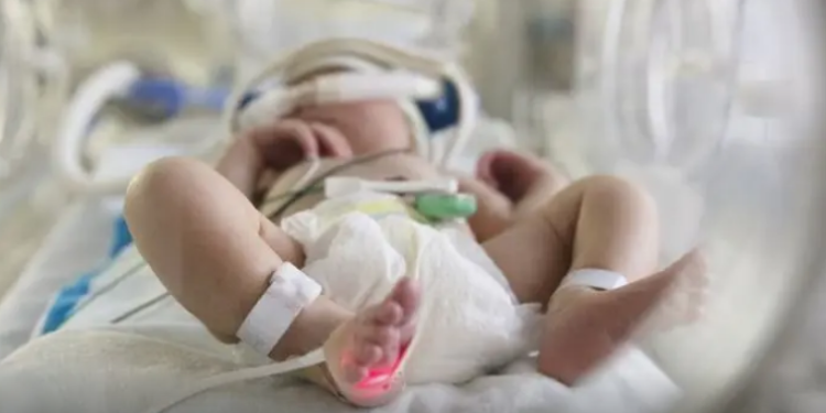 Por qué mueren 10 veces más bebés por covid-19 en Brasil que en Estados Unidos