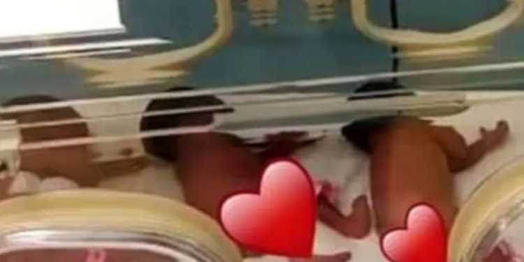 Nonillizos por sorpresa: la mujer que dio a luz a 9 bebés