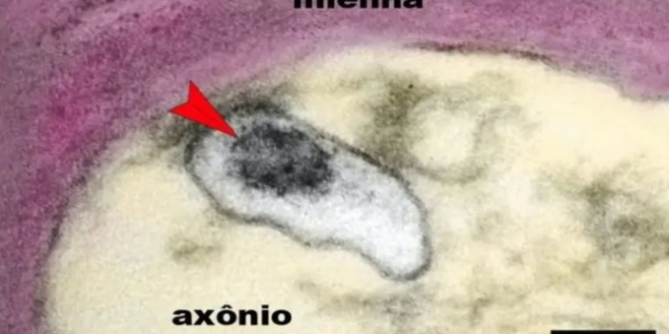 Autopsias revelan por qué es tan difícil diagnosticar covid-19 en niños